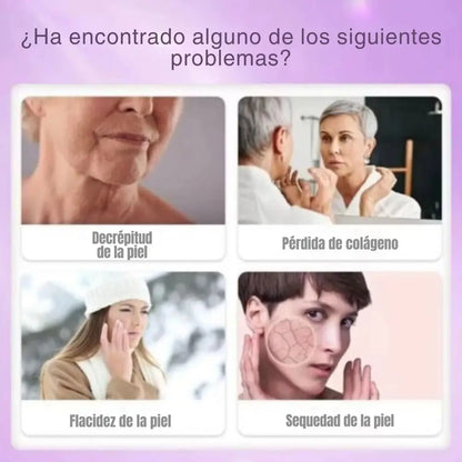 Colageno Peptides 30 Gomitas